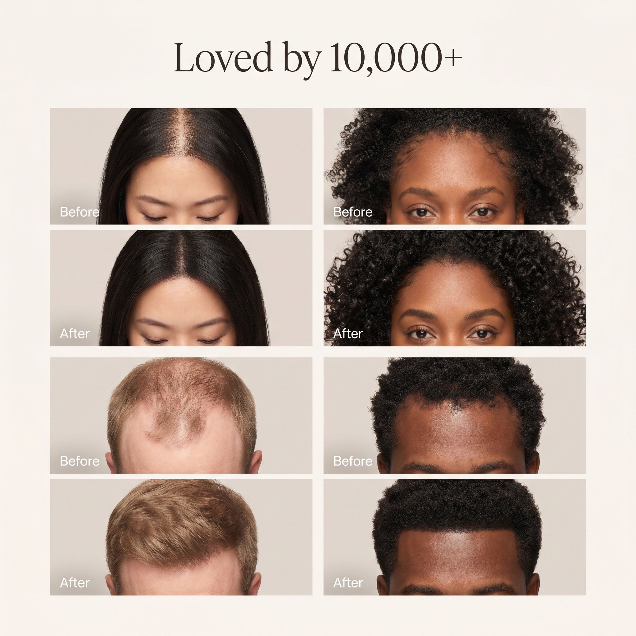 The Scalp Revival Bar